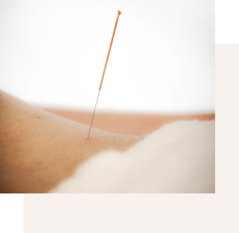 Accupuncture_762X745